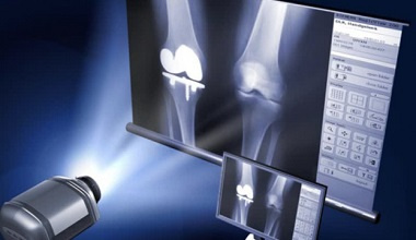 انتشار نتایج پژوهش‌های محققان دانشگاه تهران در زمینه شبیه‌سازی عددی معادلات غیرخطی سهموی تباهیده | ارتقای کیفیت تصویربرداری پزشکی با استفاده از مدل‌سازی ریاضی